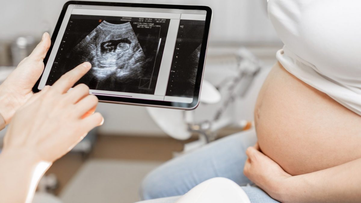 quanto pesa placenta e liquido amniotico Molte future mamme si spaventano quando vedono la bilancia salire durante  la #gravidanza. Ma la verità è che i chili in più non sono dovuti solo al  grasso corporeo. Gran parte di