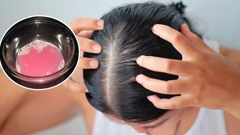 Cipolle rosse tagliate a cubetti pronte per essere utilizzate in un preparato per capelli