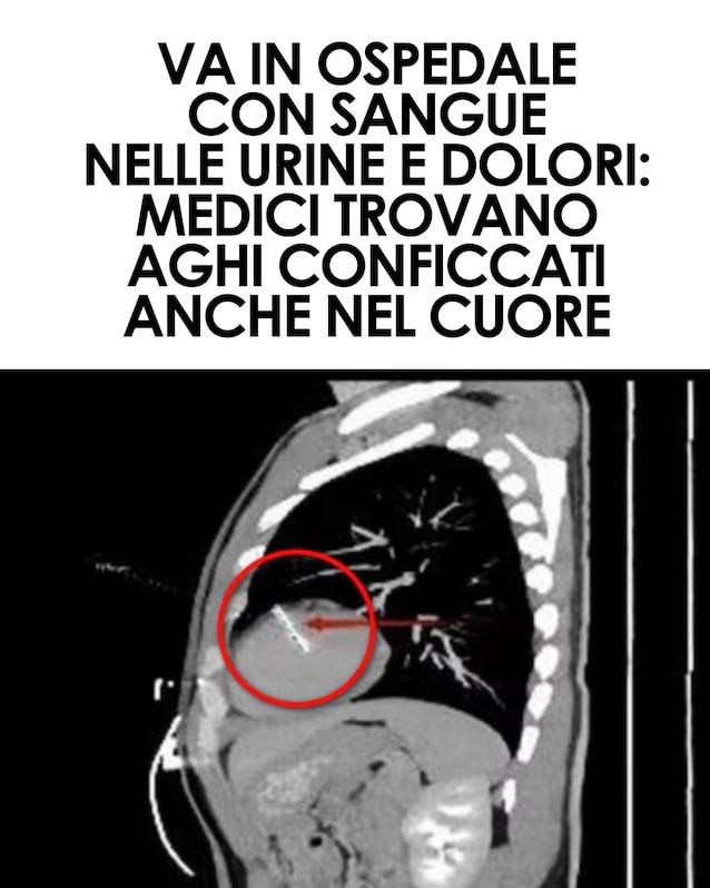 Immagine
